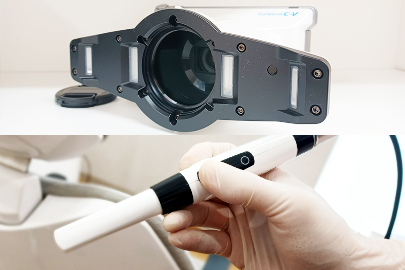 口腔内カメラ