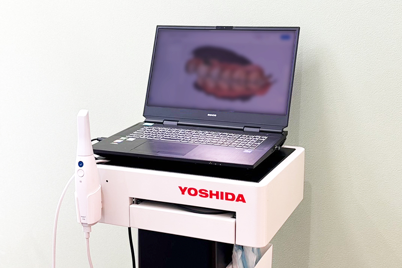 口腔内スキャナー